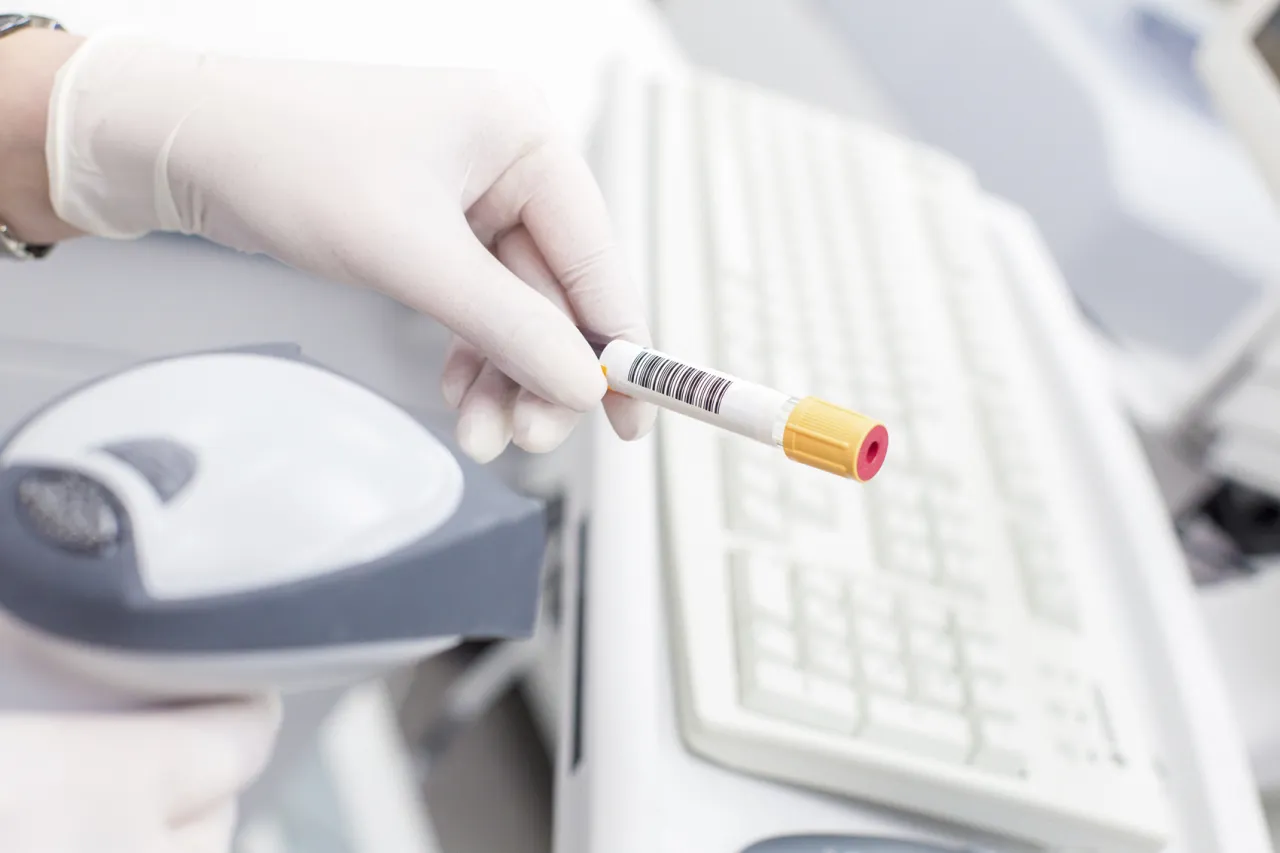 Zdjęcie Jakie badanie na cukrzycę? Poznaj kluczowe testy diagnostyczne