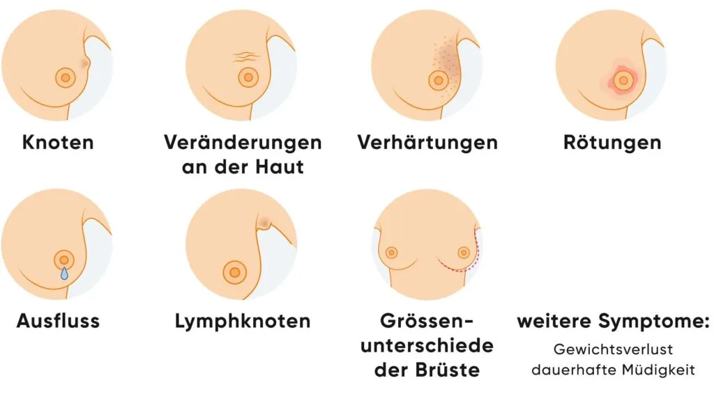 Zdjęcie Wichtige Methoden der Tumor Diagnostik: So erkennen Sie Krebs frühzeitig