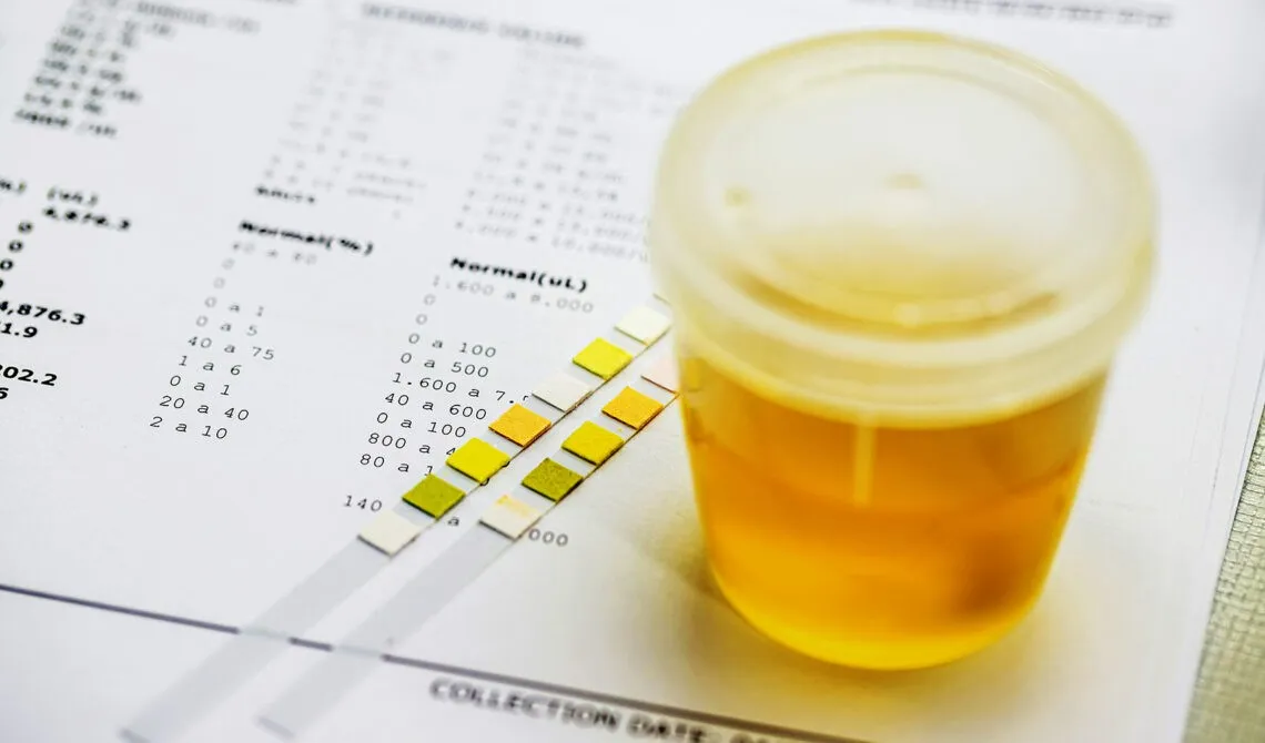 Zdjęcie Jaka ilość moczu do badania? Kluczowe informacje, które musisz znać