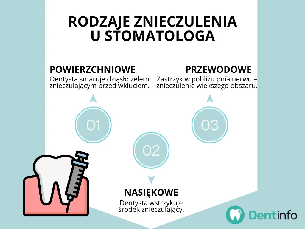 Zdjęcie Czym dentysta znieczula? Rodzaje znieczulenia i jak uniknąć bólu podczas zabiegów