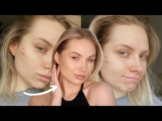Zdjęcie Jak zakryć pryszcze? Kompleksowy poradnik makijażowy i bezmakijażowy