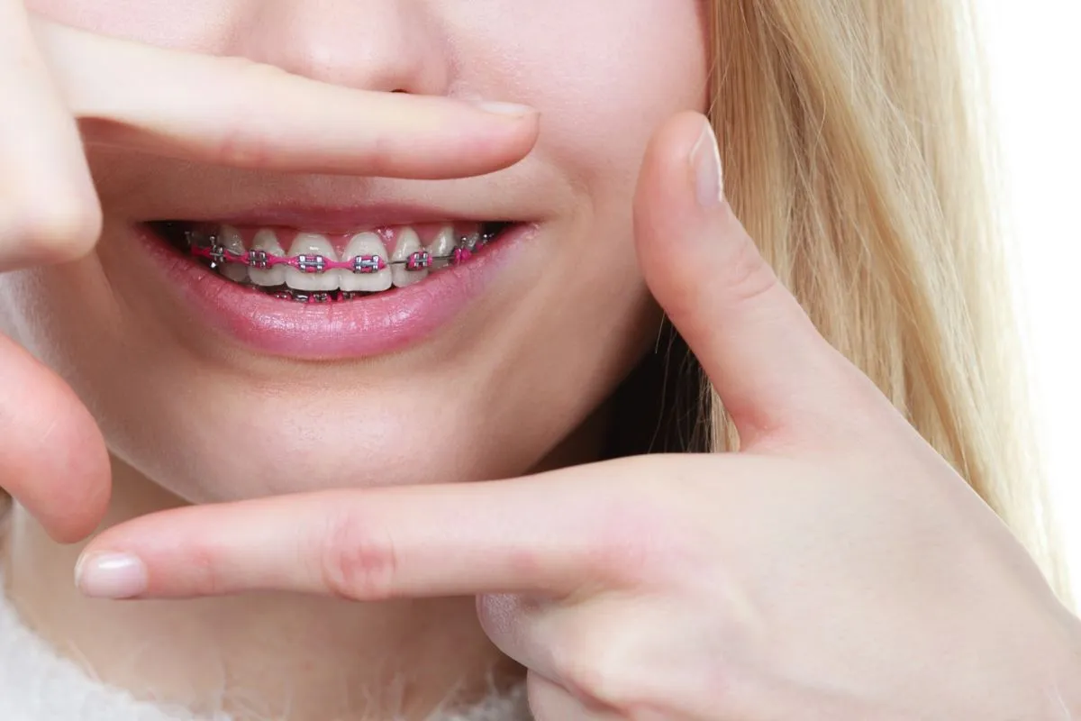 Zdjęcie Czym różni się dentysta od ortodonty i kiedy do kogo się udać? Wyjaśniamy różnice