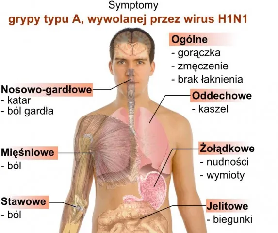 Zdjęcie Ptasia grypa objawy: Jak rozpoznać groźne symptomy u ludzi
