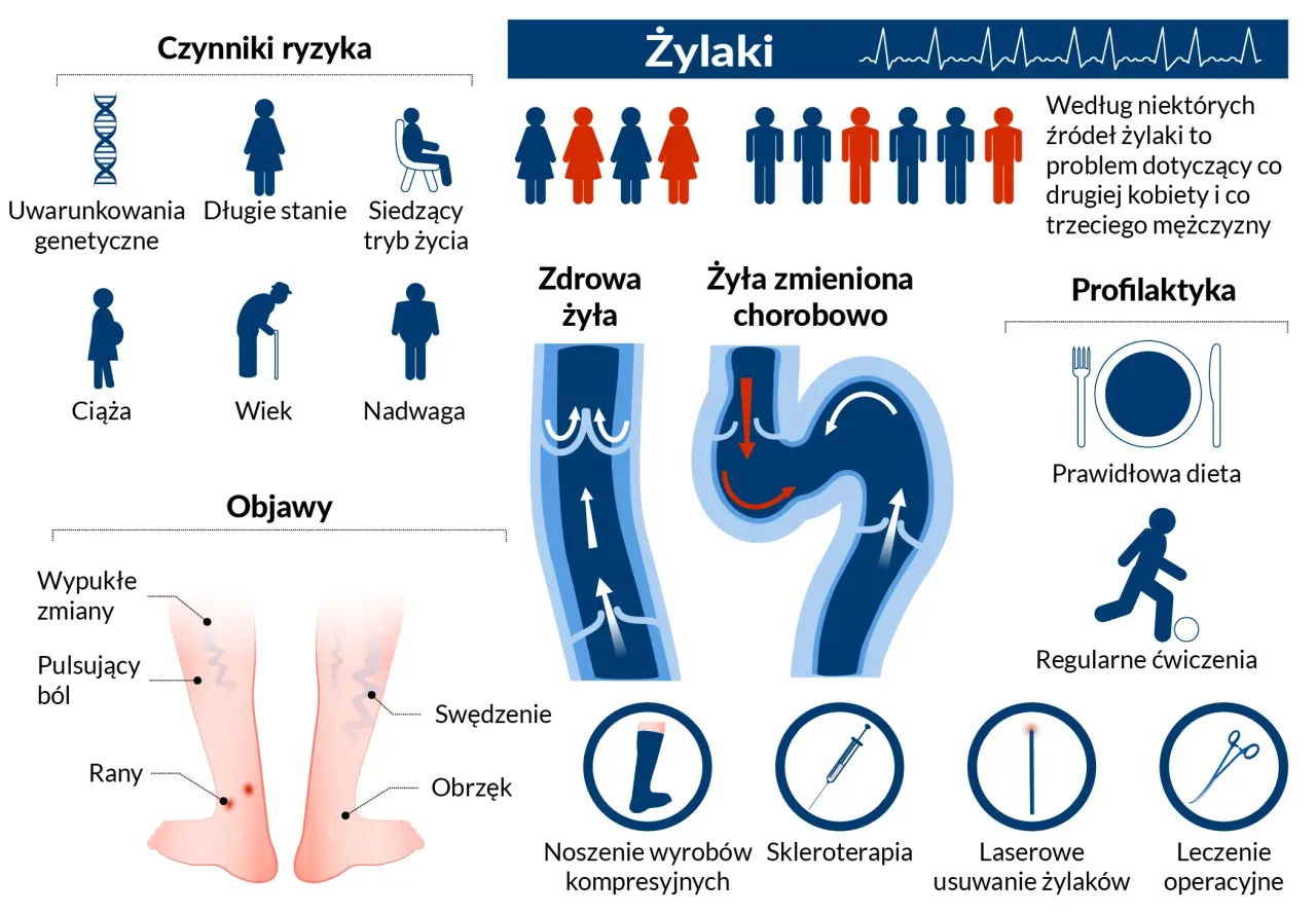 Zdjęcie Objawy żylaków przełyku: 7 kluczowych sygnałów ostrzegawczych