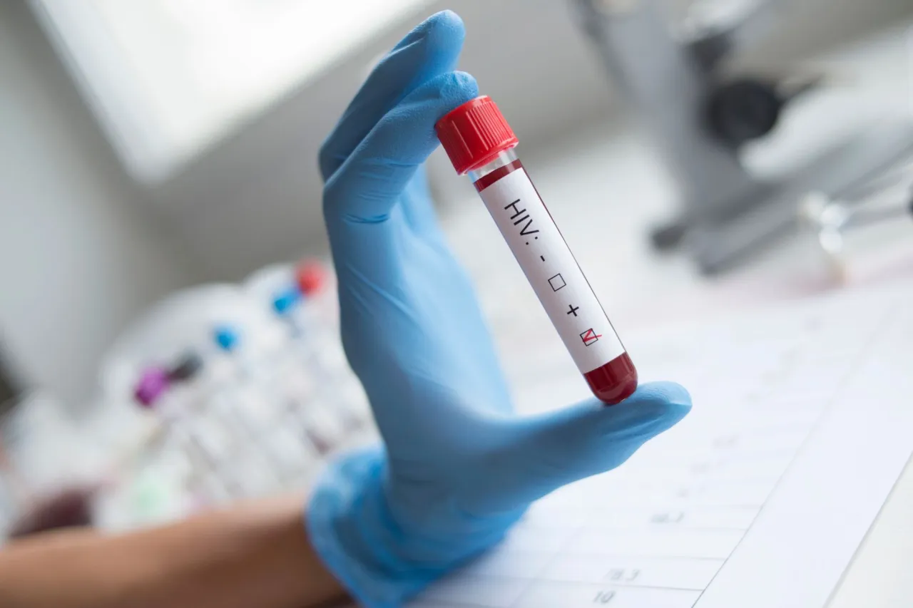 Zdjęcie Czas oczekiwania na wyniki badania HIV – ile naprawdę trzeba czekać?