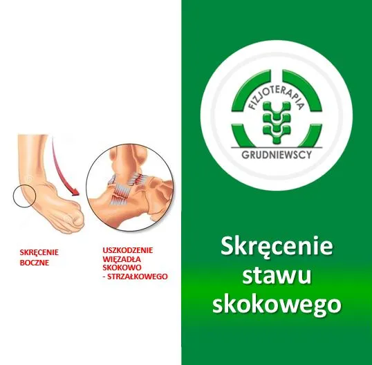 Zdjęcie Skręcenie kostki objawy: Jak rozpoznać ból i obrzęk stawu skokowego