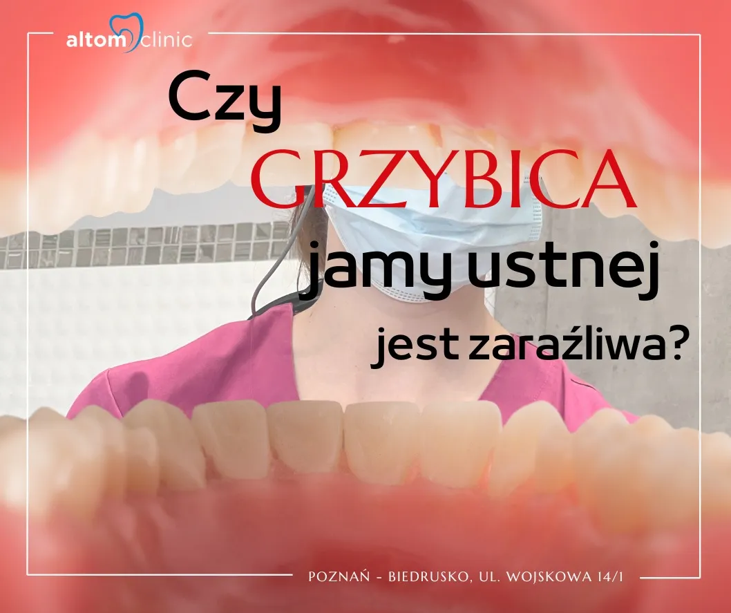 Zdjęcie Grzybica jamy ustnej czy jest zaraźliwa? Sprawdź, jak się przenosi