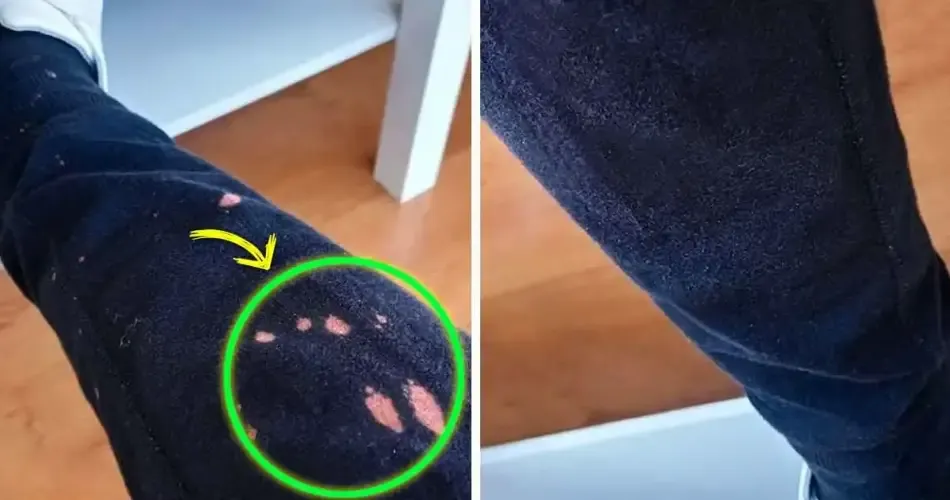 Zdjęcie Skuteczne sposoby na usunięcie plamy po wybielaczu z tkanin