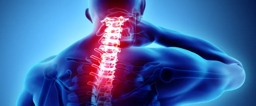 Zdjęcie Skręcenie kręgosłupa szyjnego: poważne objawy neurologiczne, które musisz znać