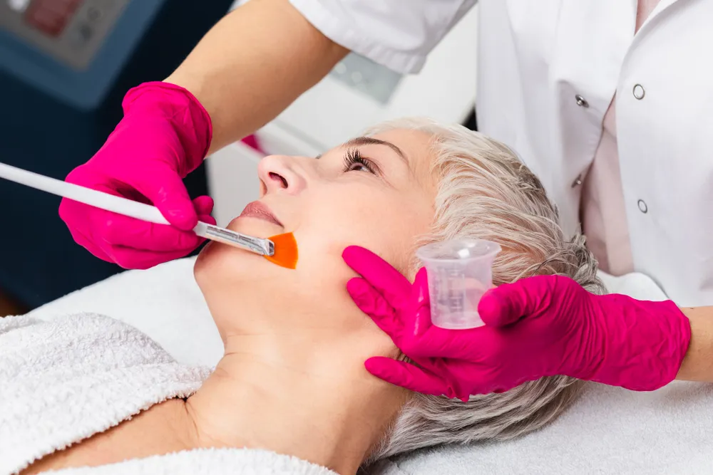 Zdjęcie Peeling chemiczny co to? Poznaj korzyści i efekty zabiegu