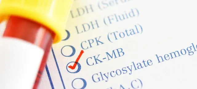 Zdjęcie Badanie CK - co to jest i jakie ma znaczenie w diagnostyce?