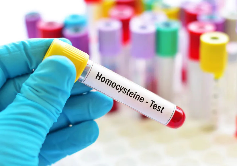 Zdjęcie Ile kosztuje badanie homocysteiny? Poznaj ceny i ważne informacje