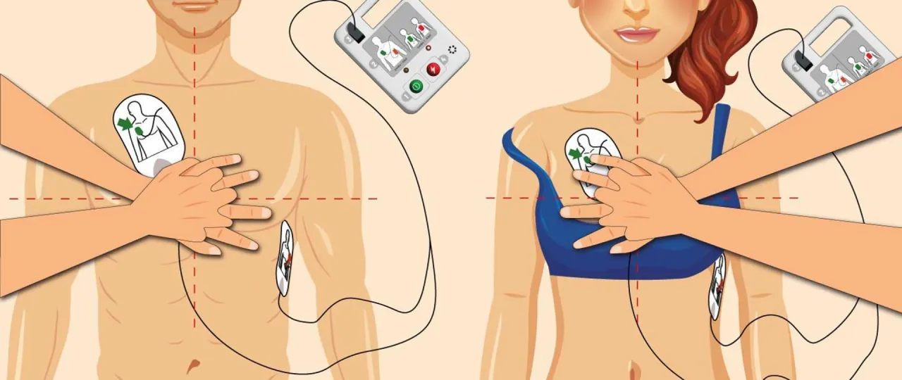 Zdjęcie Defibrylator AED: Jak działa i jak ratuje życie? Prosty przewodnik