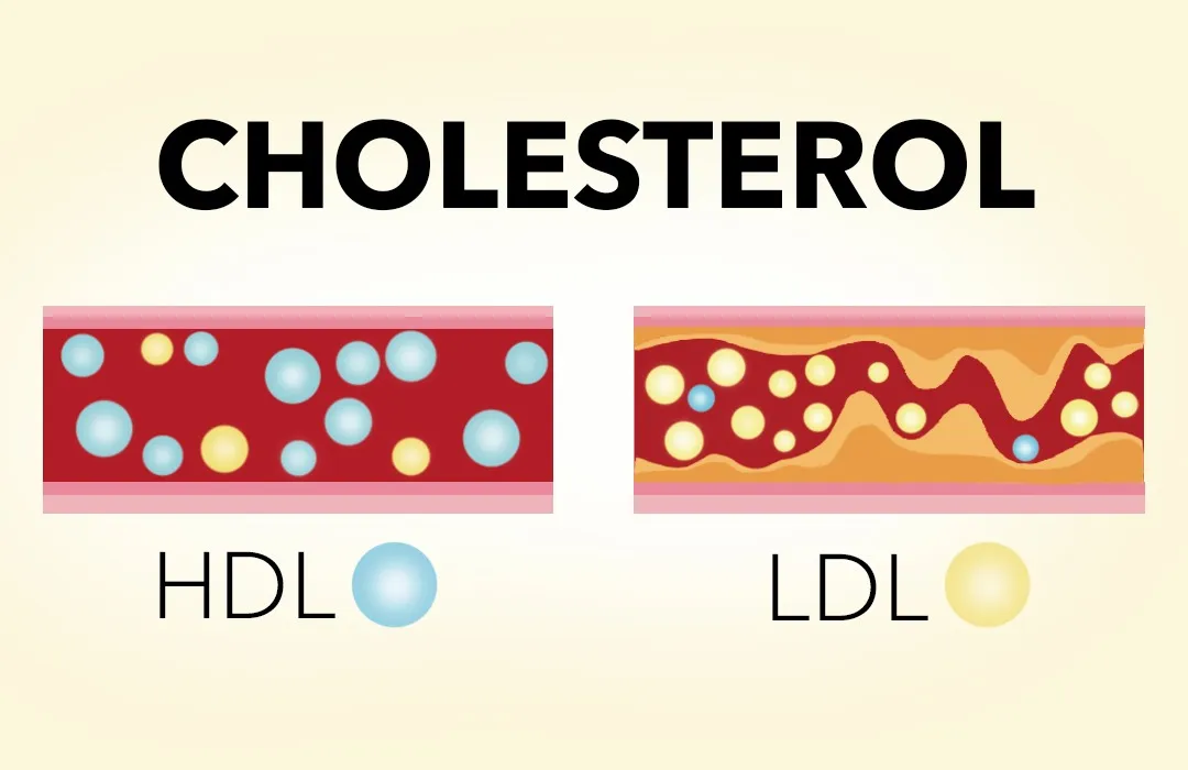 Zdjęcie Jaki cholesterol jest dobry i jak poprawić jego poziom w organizmie
