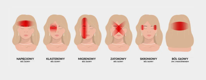 Zdjęcie B&oacute;l głowy przy nerwicy: objawy, przyczyny i skuteczne leczenie