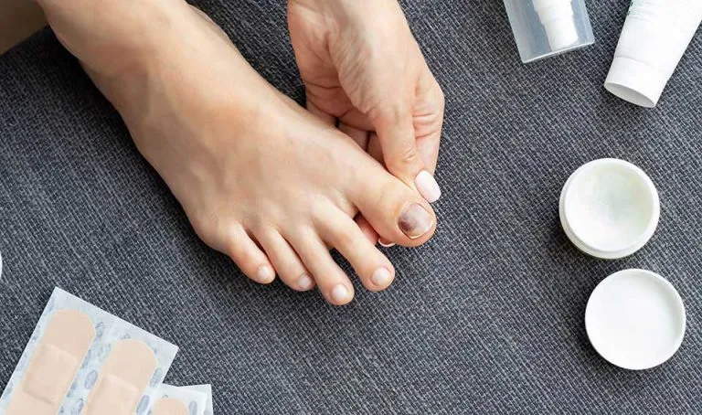 Zdjęcie Co oznacza jeden czarny paznokieć? Przyczyny i leczenie