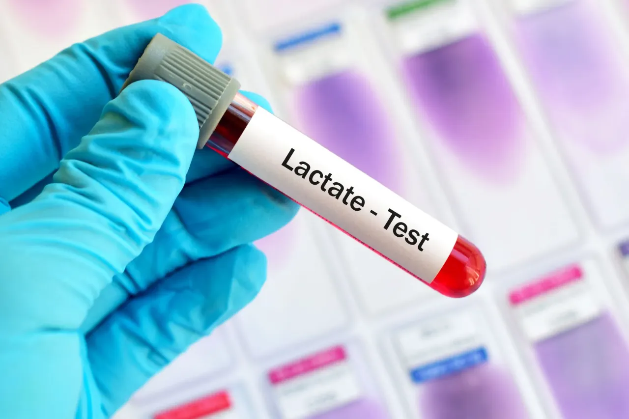 Zdjęcie Kwasica mleczanowa - jakie badania są kluczowe dla diagnozy?