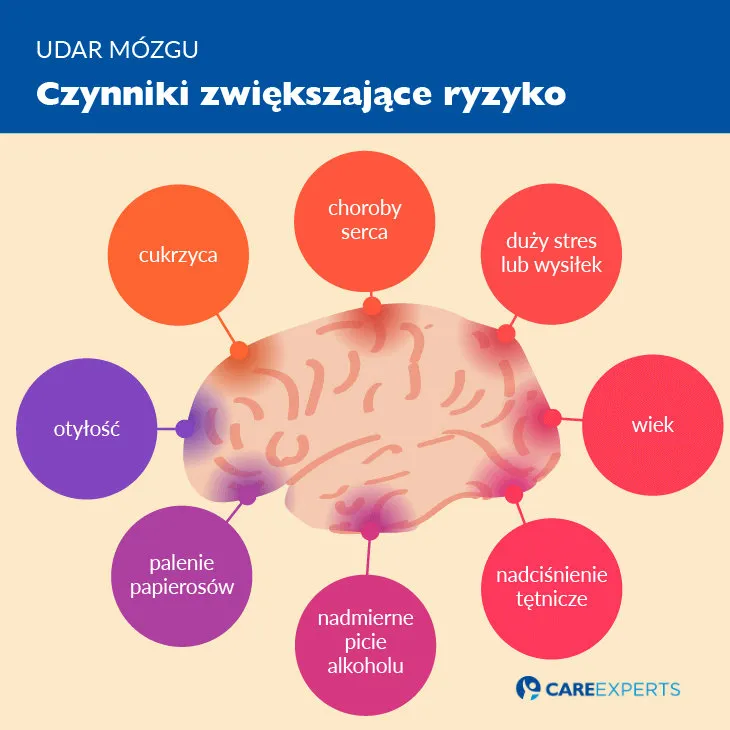 Zdjęcie Czy udar można przewidzieć? Objawy i czynniki ryzyka, które musisz znać