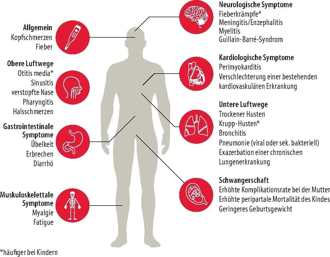 Zdjęcie Symptome aktuelle Grippe: So erkennen Sie die gefährlichen Anzeichen