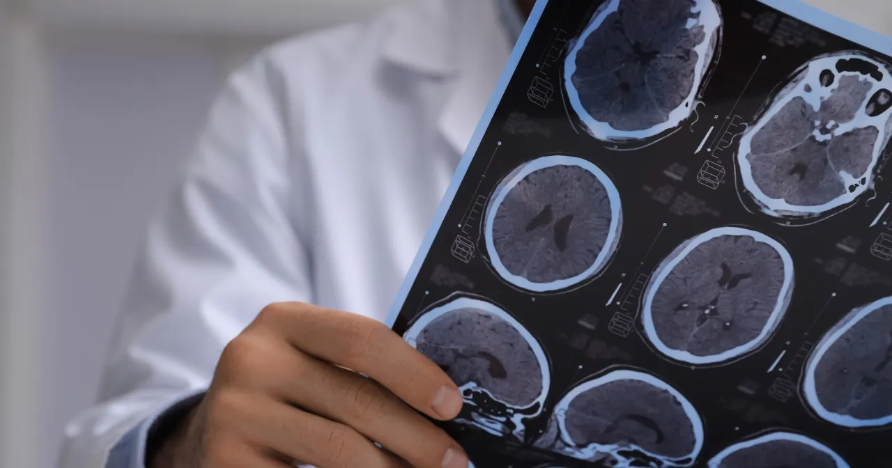 Zdjęcie Neurologia czym się zajmuje? Poznaj kluczowe aspekty tej dziedziny