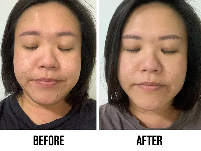 Zdjęcie Jak stosować effaclar serum ultra concentrate, aby uzyskać najlepsze efekty?