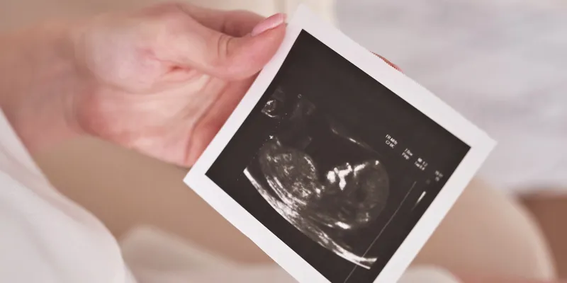 Zdjęcie Kiedy zrobić badania prenatalne, aby uniknąć nieprawidłowości?