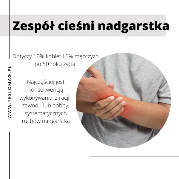 Zdjęcie Jakie leki na zespół cieśni nadgarstka mogą przynieść ulgę w bólu?