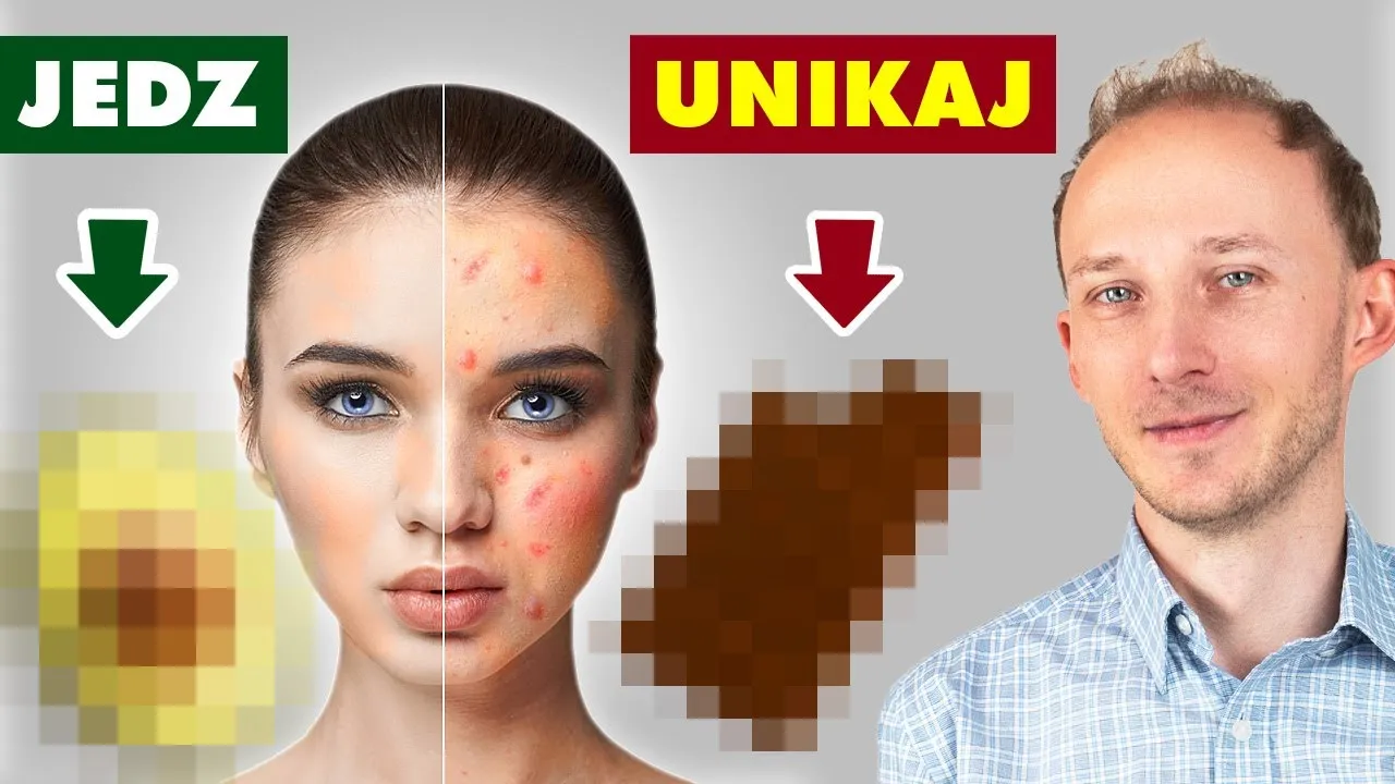 Zdjęcie Co jeść na cerę trądzikową, aby skutecznie walczyć z niedoskonałościami