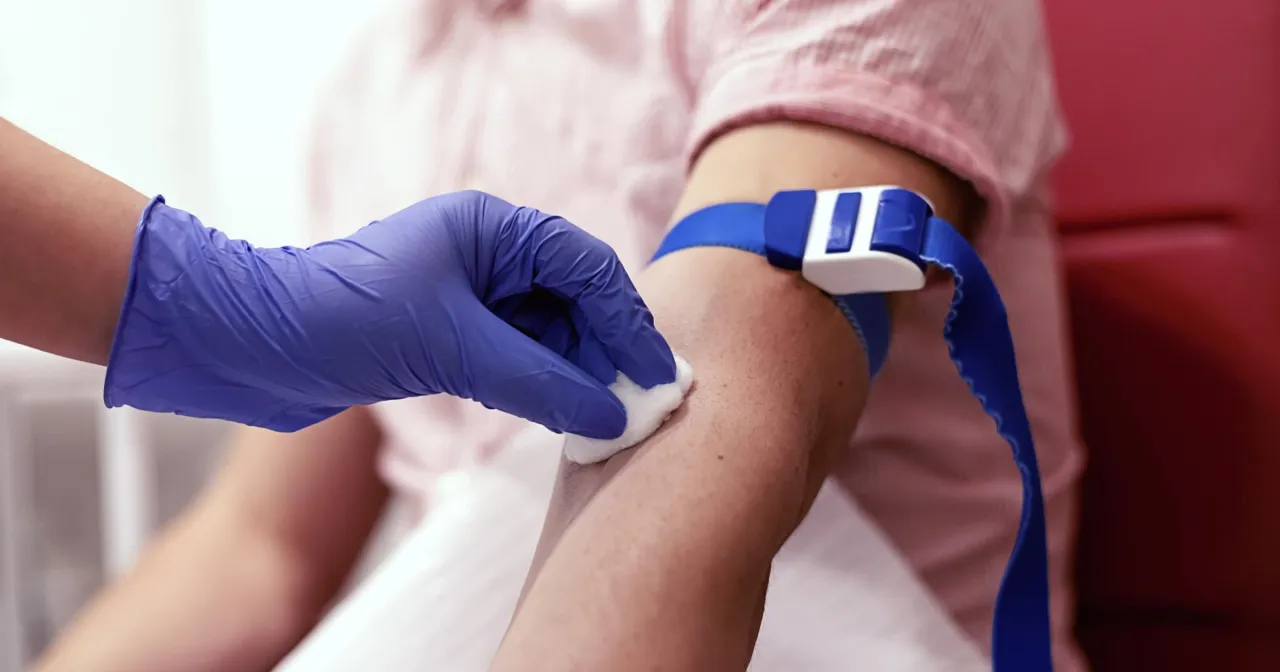 Zdjęcie LH badanie u mężczyzn: wszystko co musisz wiedzieć o diagnostyce hormonu