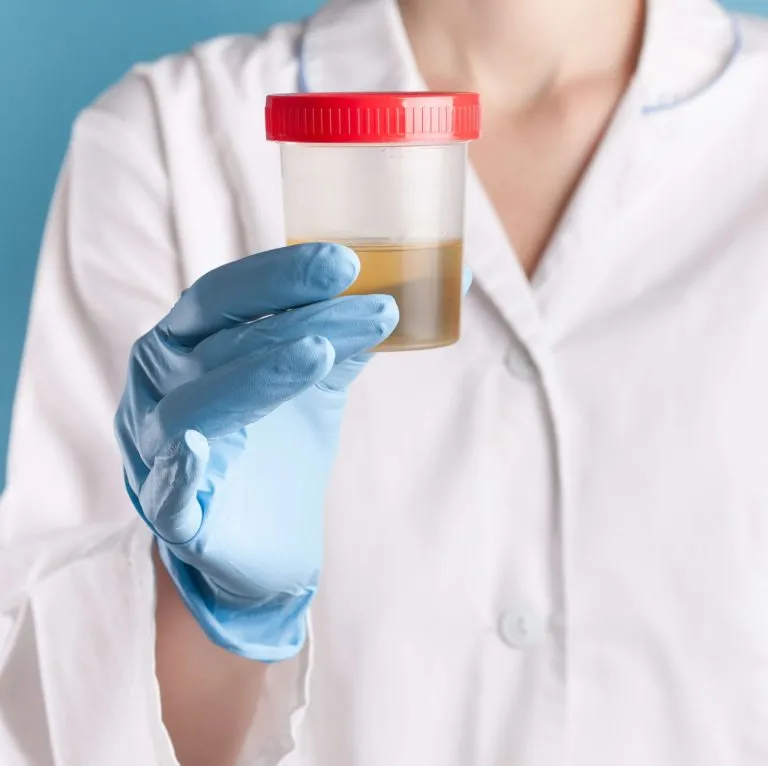 Zdjęcie Jak przechowywać mocz przed oddaniem do laboratorium, aby uniknąć błędów