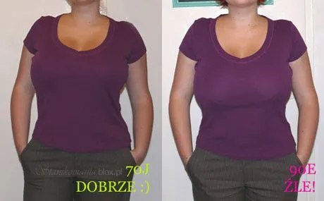 Zdjęcie Ile się czeka na zmniejszenie biustu NFZ? Czas oczekiwania i wskazania