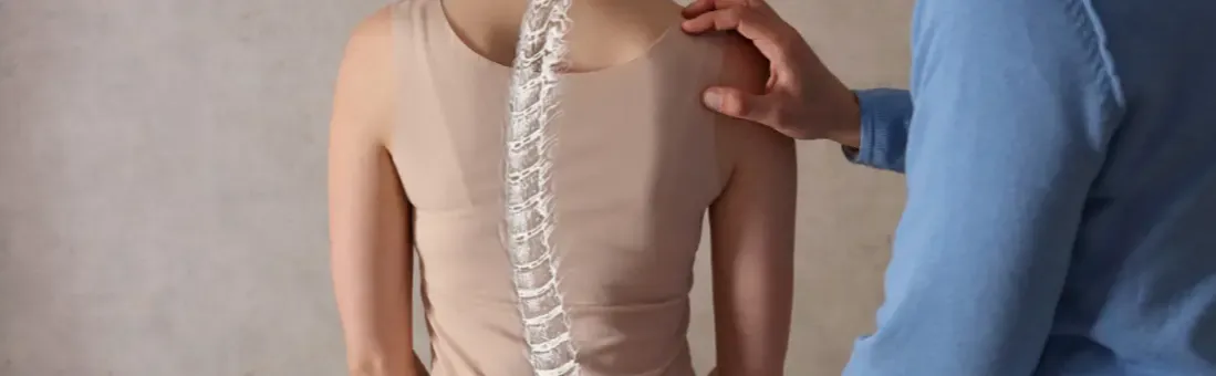 Zdjęcie Skolioza: jakich ćwiczeń nie wykonywać, by uniknąć bólu i kontuzji