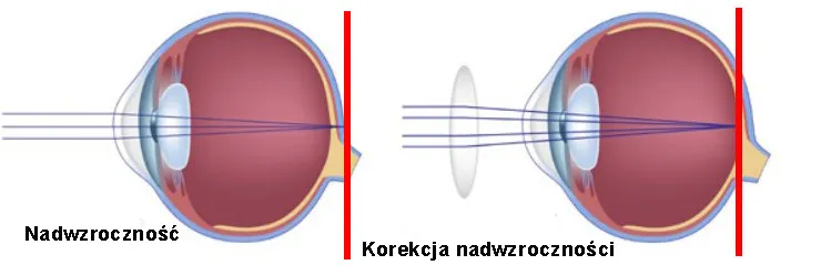 Zdjęcie Jak powstają wady wzroku i jak ich unikać w codziennym życiu