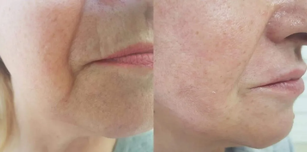 Zdjęcie Jak poprawić owal twarzy po 60: 10 skutecznych metod