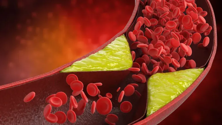 Zdjęcie Czy alkohol podnosi cholesterol? Wpływ alkoholu na zdrowie i poziom cholesterolu