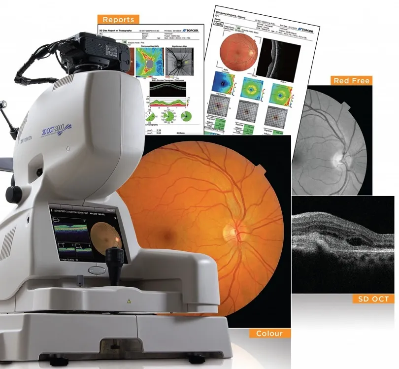 Zdjęcie Jak wygląda badanie na jaskrę? Poznaj kluczowe etapy diagnostyki