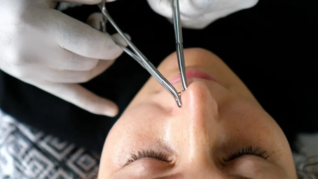 Zdjęcie Czy kolczyk w nosie jest bezpieczny? Poznaj ryzyka i zasady pielęgnacji