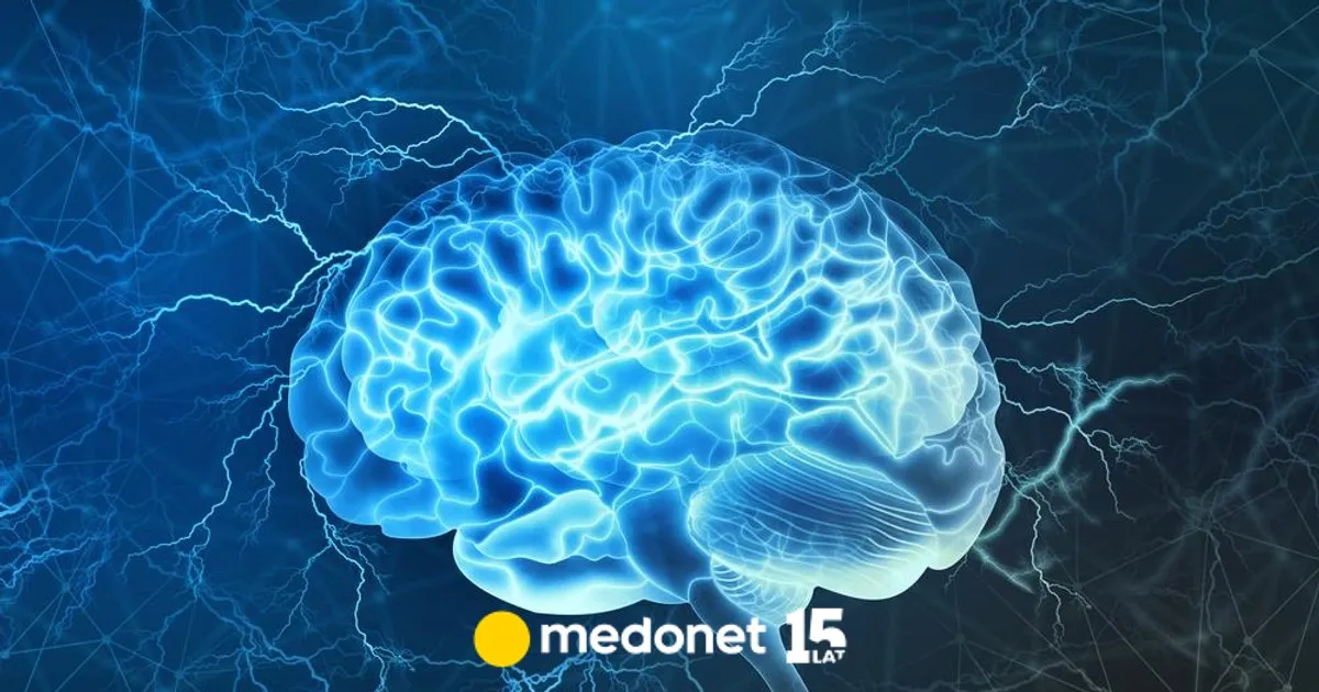 Zdjęcie Co po udarze niedokrwiennym? Kluczowe informacje o rehabilitacji i leczeniu