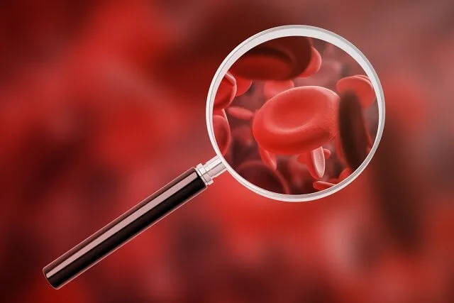 Zdjęcie Norma cholesterolu HDL – sprawdź, jakie wartości są niebezpieczne