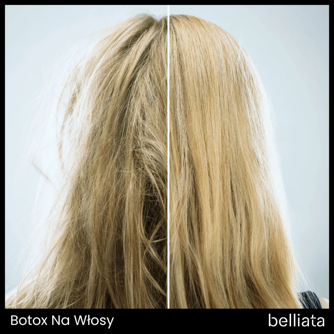Zdjęcie Co to jest botox na włosy i jak może uratować Twoje zniszczone kosmyki
