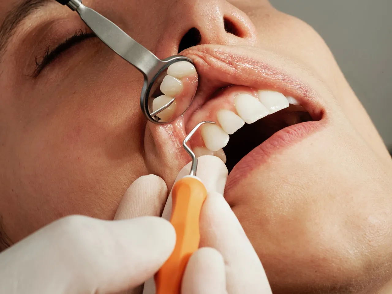 Zdjęcie Co można zrobić u dentysty na nfz? Sprawdź, co zyskasz bezpłatnie