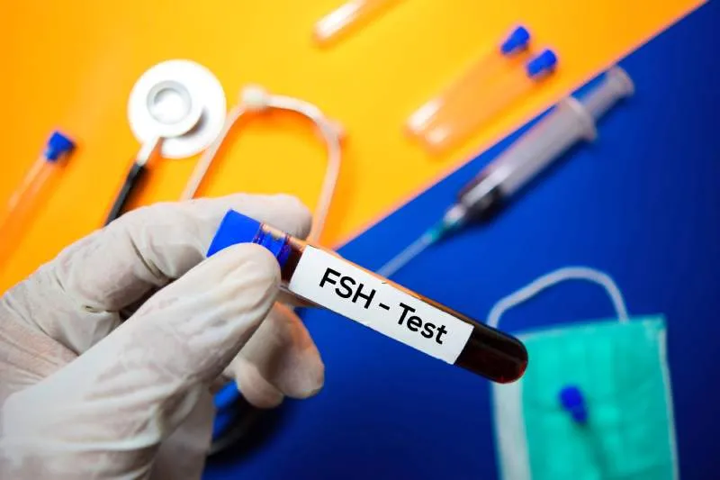 Zdjęcie Jakie badanie krwi na menopauzę? Kluczowe testy dla zdrowia kobiet