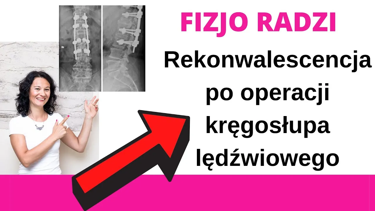 Zdjęcie Kiedy rehabilitacja po operacji kręgosłupa lędźwiowego - co musisz wiedzieć?