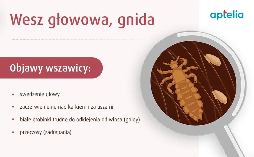 Zdjęcie Czy wszawica jest chorobą zakaźną? Co rodzic musi wiedzieć o zarażeniu