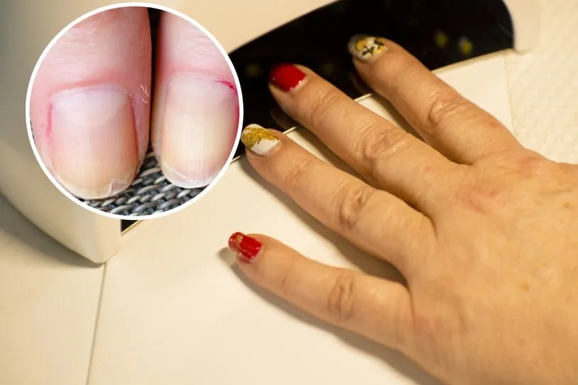 Zdjęcie Najlepszy manicure na zniszczone paznokcie - 5 skutecznych metod