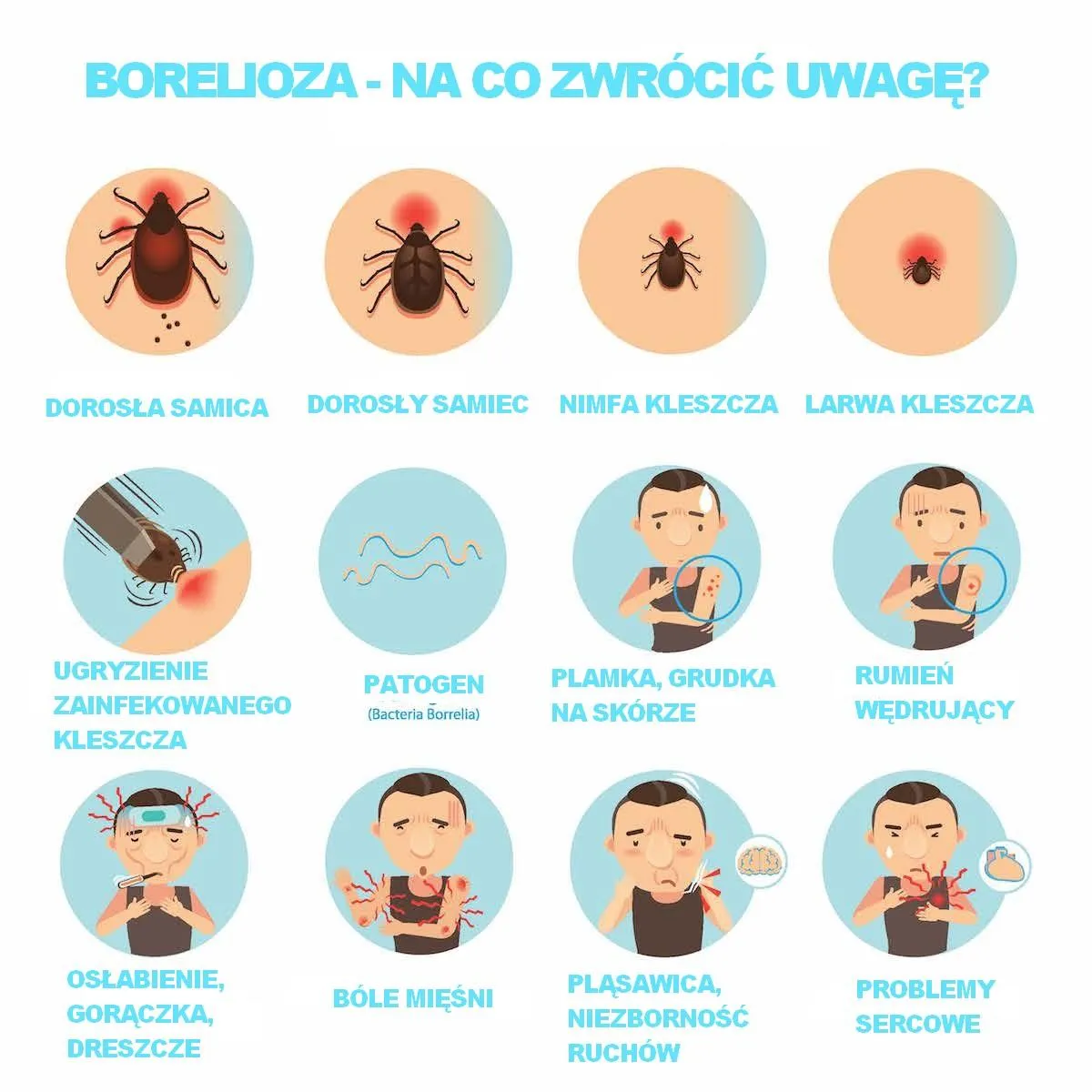Zdjęcie Borelioza objawy wzroku: jak rozpoznać groźne symptomy?
