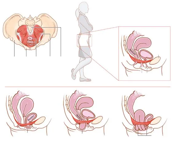 Zdjęcie Jak ćwiczyć mięśnie Kegla na siedząco, aby uniknąć problemów zdrowotnych