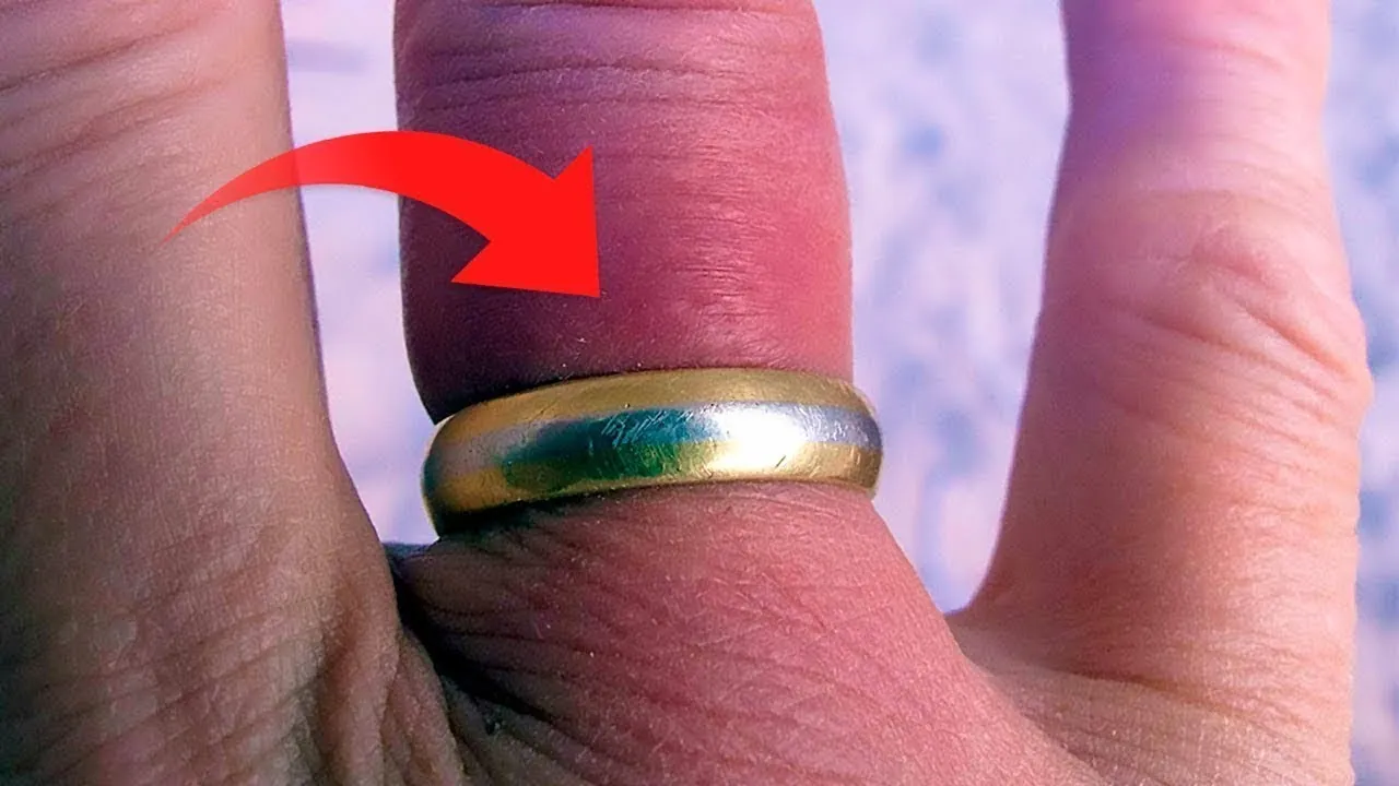 Zdjęcie Jak ściągnąć za małą obrączkę z palca bez bólu i ryzyka