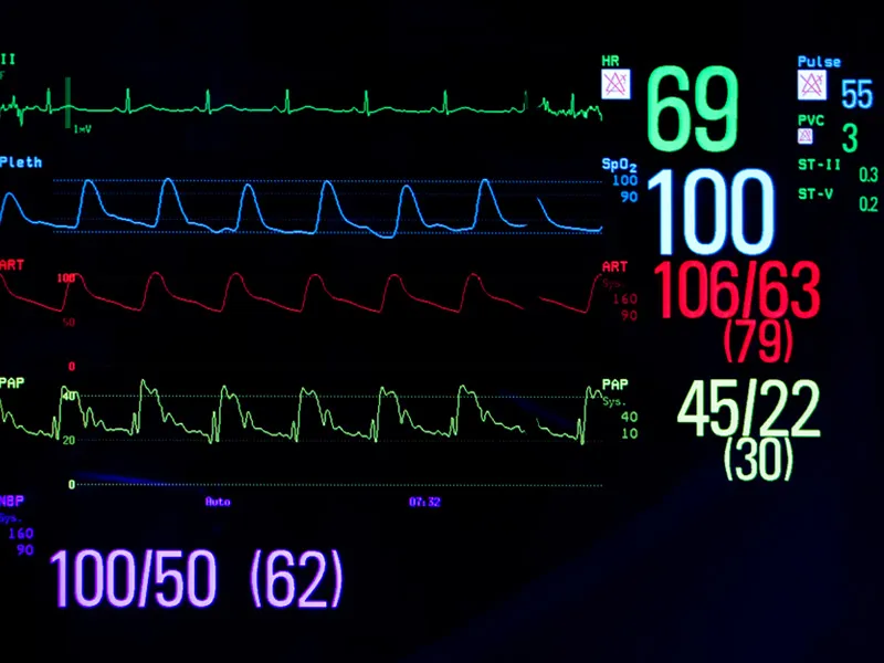 Zdjęcie Prawidłowy puls spoczynkowy: Normy, pomiar i co oznaczają dla zdrowia