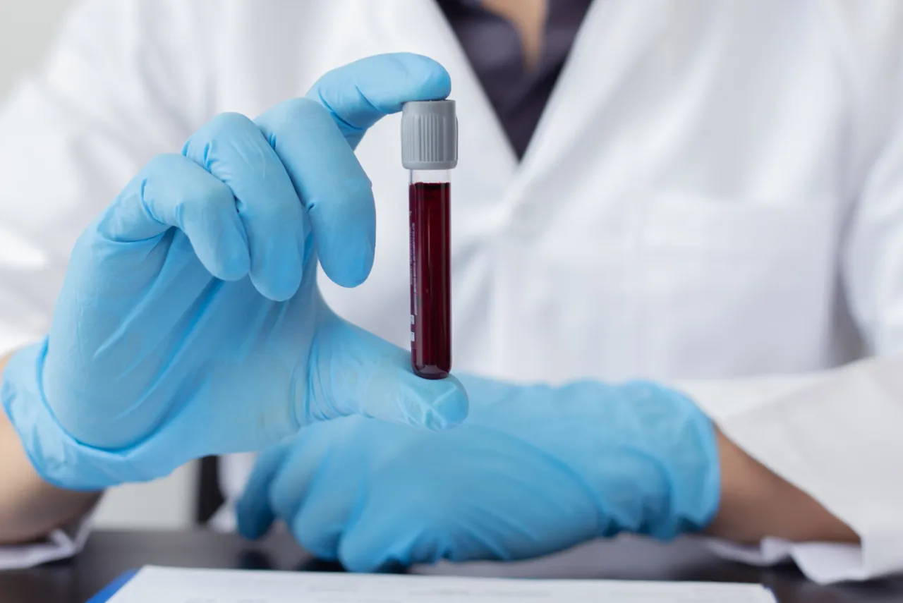Zdjęcie Niedobór noradrenaliny objawy: poznaj symptomy, które mogą zaskoczyć
